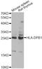 Major Histocompatibility Complex, Class II, DP Beta 1 antibody, LS-C749010, Lifespan Biosciences, Western Blot image 