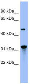 Nitrilase homolog 1 antibody, TA342250, Origene, Western Blot image 