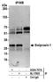 EF-Hand Domain Family Member D2 antibody, A304-737A, Bethyl Labs, Immunoprecipitation image 