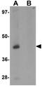 Proline Rich 5 antibody, GTX31436, GeneTex, Western Blot image 