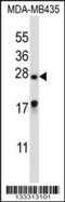 Male-Enhanced Antigen 1 antibody, 56-983, ProSci, Western Blot image 