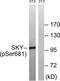 MER Proto-Oncogene, Tyrosine Kinase antibody, TA312806, Origene, Western Blot image 