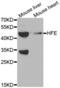 Homeostatic Iron Regulator antibody, abx001186, Abbexa, Western Blot image 