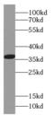 Capping Actin Protein Of Muscle Z-Line Subunit Alpha 1 antibody, FNab01257, FineTest, Western Blot image 