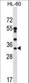 DnaJ Heat Shock Protein Family (Hsp40) Member C17 antibody, LS-C159475, Lifespan Biosciences, Western Blot image 