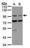 Axin 1 antibody, PA5-34703, Invitrogen Antibodies, Western Blot image 