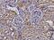 Profilin 2 antibody, GTX02270, GeneTex, Immunohistochemistry paraffin image 
