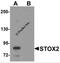 Storkhead Box 2 antibody, 6061, ProSci, Western Blot image 