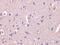 Dihydropyrimidinase-related protein 1 antibody, 3623, ProSci Inc, Immunohistochemistry paraffin image 