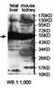 Arylsulfatase A antibody, orb78452, Biorbyt, Western Blot image 