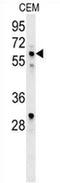IK1 antibody, AP52180PU-N, Origene, Western Blot image 