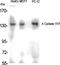 Adenylate cyclase type 5 antibody, A04197, Boster Biological Technology, Western Blot image 
