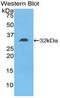 Diacylglycerol Kinase Epsilon antibody, LS-C293680, Lifespan Biosciences, Western Blot image 
