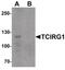 T Cell Immune Regulator 1, ATPase H+ Transporting V0 Subunit A3 antibody, PA5-34419, Invitrogen Antibodies, Western Blot image 
