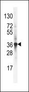 Low Density Lipoprotein Receptor Adaptor Protein 1 antibody, 63-341, ProSci, Western Blot image 