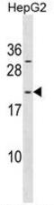 ADP Ribosylation Factor Like GTPase 6 Interacting Protein 1 antibody, AP50246PU-N, Origene, Western Blot image 