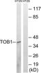 Protein Tob1 antibody, abx012991, Abbexa, Western Blot image 