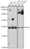 Monoglyceride Lipase antibody, GTX33321, GeneTex, Western Blot image 