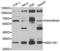 Hydroxysteroid 11-Beta Dehydrogenase 1 antibody, LS-C335178, Lifespan Biosciences, Western Blot image 