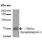 Synaptotagmin 3 antibody, MA5-27604, Invitrogen Antibodies, Western Blot image 
