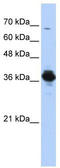 ATPase H+ Transporting V0 Subunit D2 antibody, TA329773, Origene, Western Blot image 