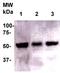 Legumain antibody, TA354520, Origene, Western Blot image 