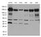Cadherin 2 antibody, M01577-3, Boster Biological Technology, Western Blot image 