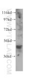 Farnesyltransferase, CAAX Box, Beta antibody, 11507-1-AP, Proteintech Group, Western Blot image 