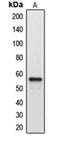 Cytochrome P450 Family 2 Subfamily A Member 7 antibody, orb213816, Biorbyt, Western Blot image 