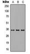 Carcinoembryonic Antigen Related Cell Adhesion Molecule 6 antibody, LS-C354323, Lifespan Biosciences, Western Blot image 