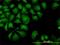 Ro60, Y RNA Binding Protein antibody, H00006738-M03, Novus Biologicals, Immunocytochemistry image 