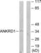 Ankyrin repeat domain-containing protein 1 antibody, LS-C119056, Lifespan Biosciences, Western Blot image 