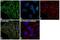 FER Tyrosine Kinase antibody, MA5-15357, Invitrogen Antibodies, Immunofluorescence image 