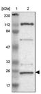 Germinal Center Associated Signaling And Motility antibody, NBP1-82693, Novus Biologicals, Western Blot image 