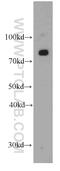 Carnitine Palmitoyltransferase 1A antibody, 66039-1-Ig, Proteintech Group, Western Blot image 