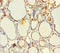 EMAP Like 2 antibody, LS-C369576, Lifespan Biosciences, Immunohistochemistry paraffin image 