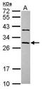 Coiled-Coil Domain Containing 70 antibody, GTX120333, GeneTex, Western Blot image 