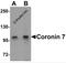 Coronin 7 antibody, 6451, ProSci Inc, Western Blot image 