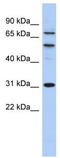 Structure Specific Recognition Protein 1 antibody, TA329211, Origene, Western Blot image 