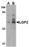 Probable ATP-dependent RNA helicase DHX58 antibody, TA306480, Origene, Western Blot image 