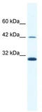DNA dC->dU-editing enzyme APOBEC-3G antibody, TA333718, Origene, Western Blot image 
