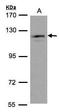 Ubiquitin Specific Peptidase 11 antibody, GTX101446, GeneTex, Western Blot image 