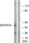 Zinc Finger DHHC-Type Containing 9 antibody, LS-B8575, Lifespan Biosciences, Western Blot image 