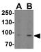 Leucine Rich Repeat Containing 8 VRAC Subunit A antibody, GTX31953, GeneTex, Western Blot image 