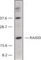 CASP2 And RIPK1 Domain Containing Adaptor With Death Domain antibody, PA1-30805, Invitrogen Antibodies, Western Blot image 