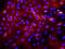 Laminin Subunit Alpha 3 antibody, MAB2144, R&D Systems, Immunofluorescence image 