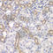 Kelch Like ECH Associated Protein 1 antibody, A1820, ABclonal Technology, Immunohistochemistry paraffin image 
