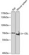 Carboxyl Ester Lipase antibody, A01821, Boster Biological Technology, Western Blot image 