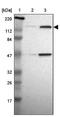 Forkhead box protein E1 antibody, NBP1-83148, Novus Biologicals, Western Blot image 