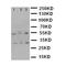 Heat Shock Protein Family H (Hsp110) Member 1 antibody, orb76122, Biorbyt, Western Blot image 